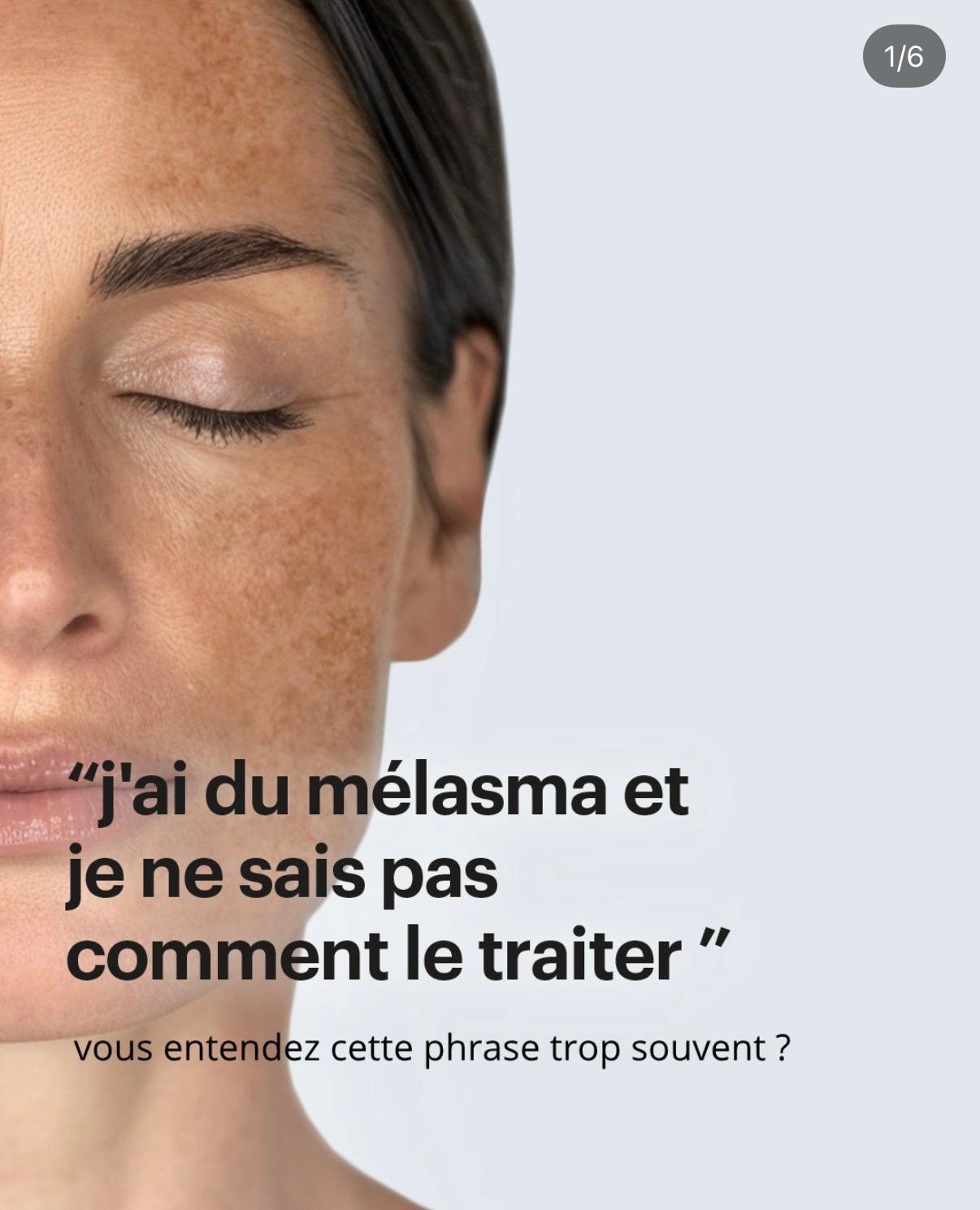 Microneedling institut beauté Mougins Sabrina Versace Beauty Time
